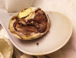 This is an image of Balut, a delacasy from the Phillipines. It is a partiall fertalized egg.